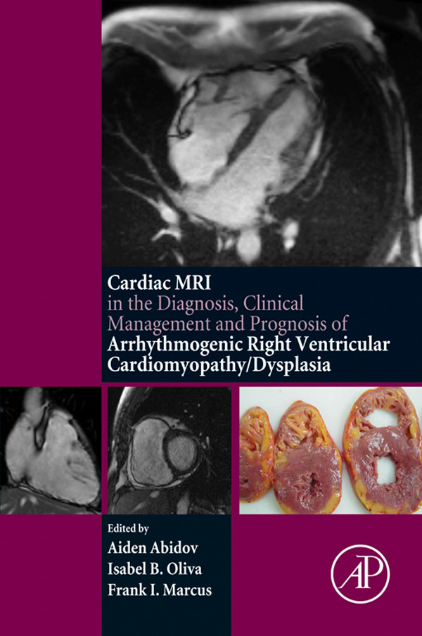 Cover The Cardiac MRI in Diagnosis, Clinical Management, and Prognosis of Arrhythmogenic Right Ventricular Cardiomyopathy/Dysplasia