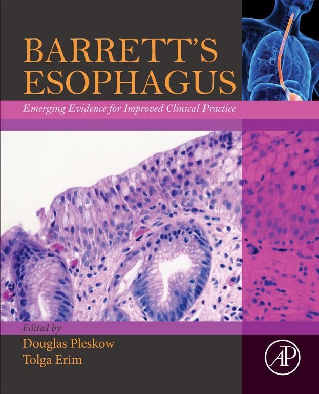 Cover Barrett's Esophagus
