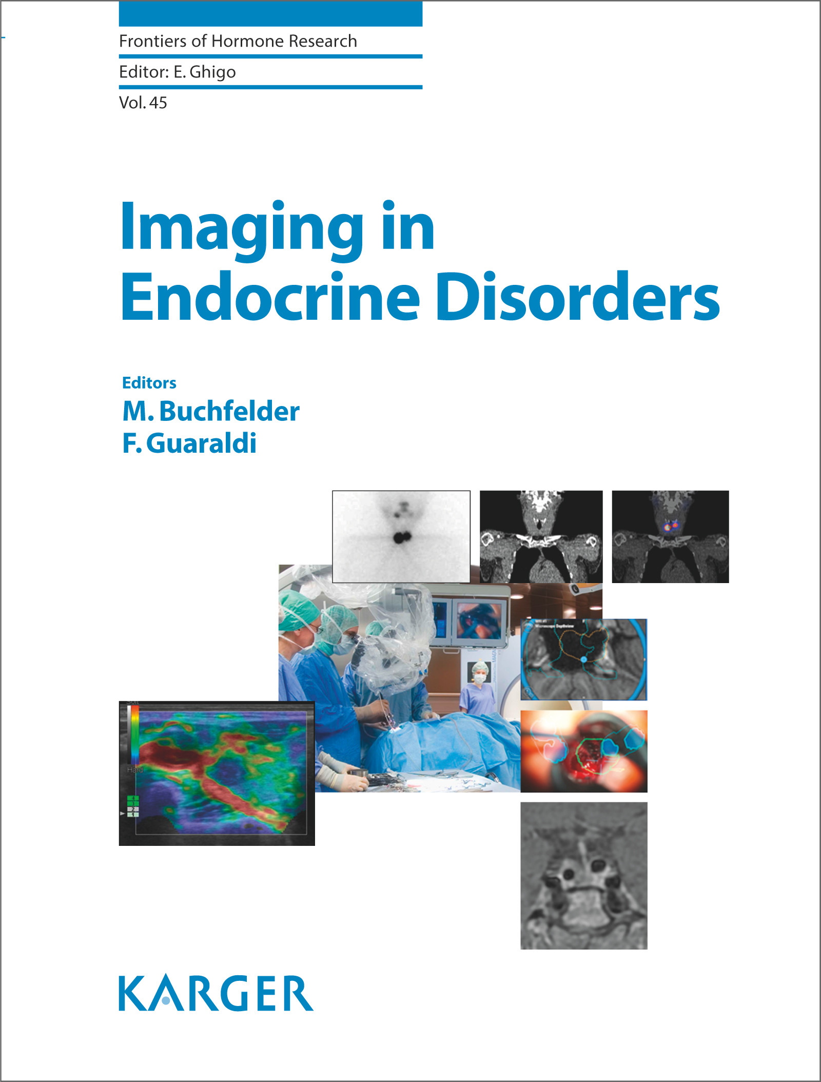 Cover Imaging in Endocrine Disorders