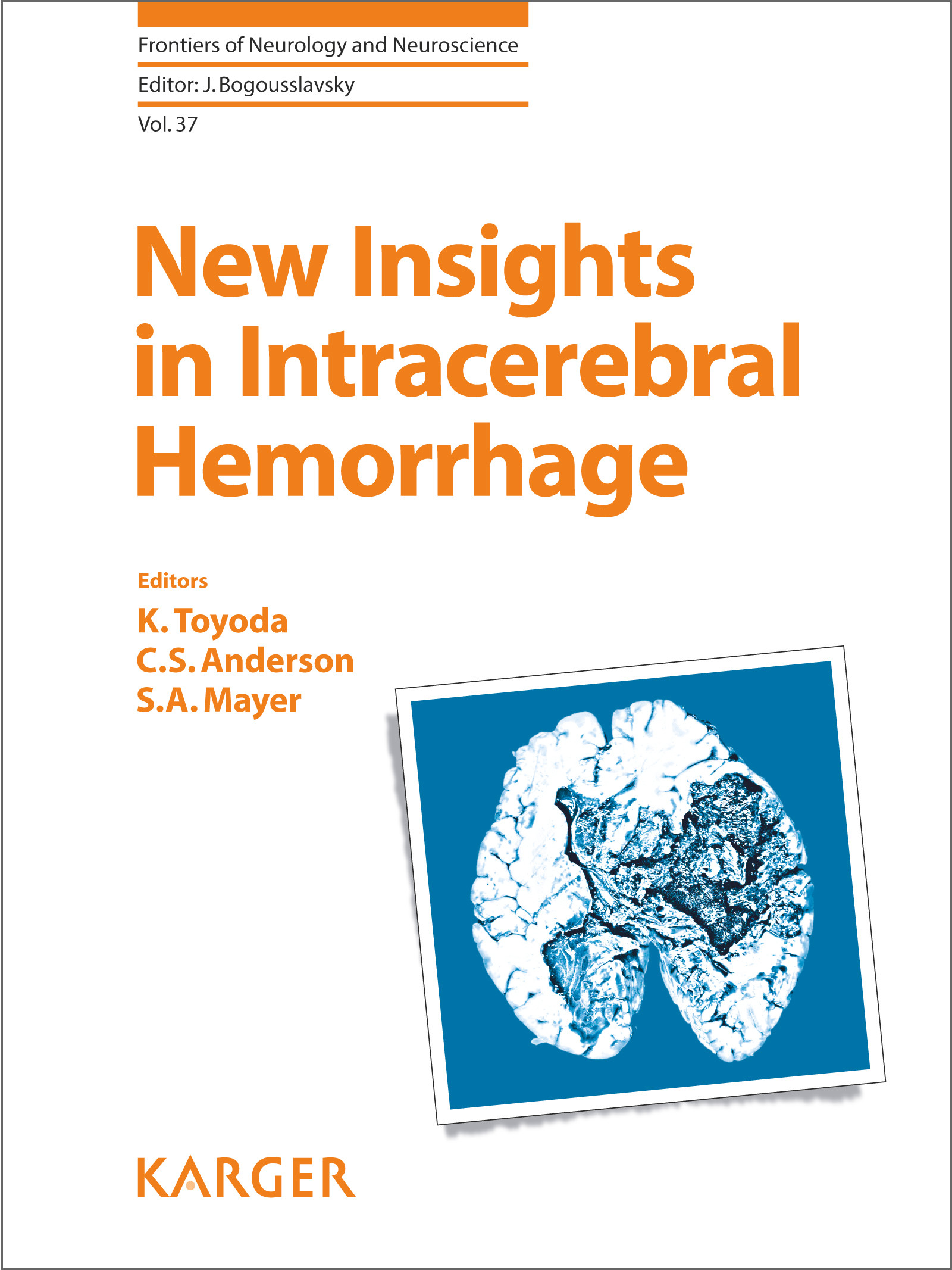 Cover New Insights in Intracerebral Hemorrhage