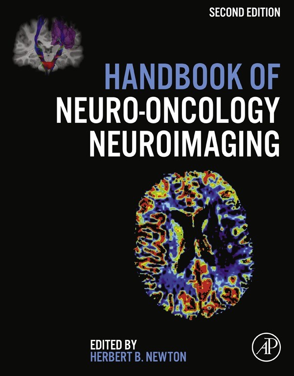 Cover Handbook of Neuro-Oncology Neuroimaging