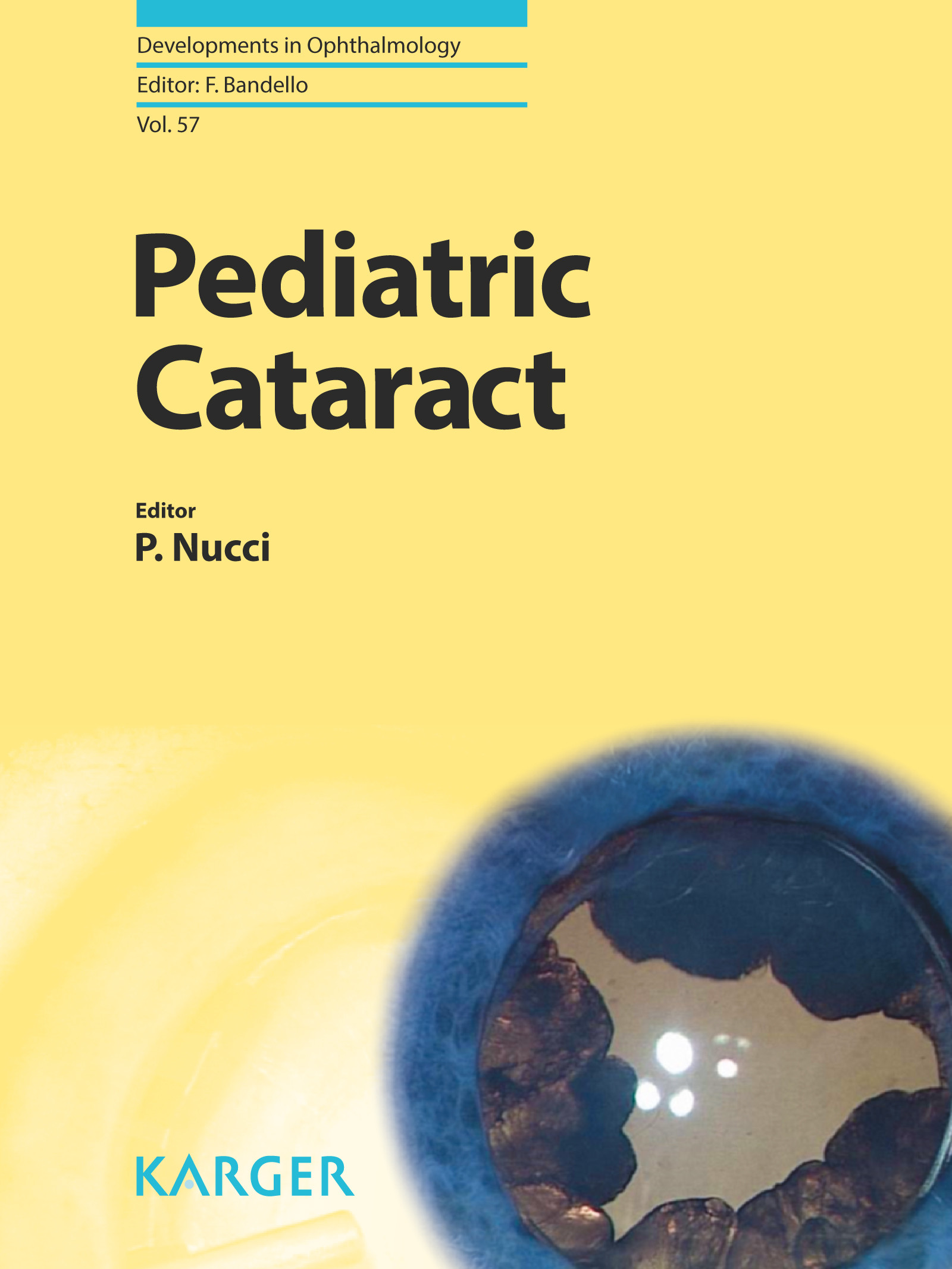 Cover Pediatric Cataract