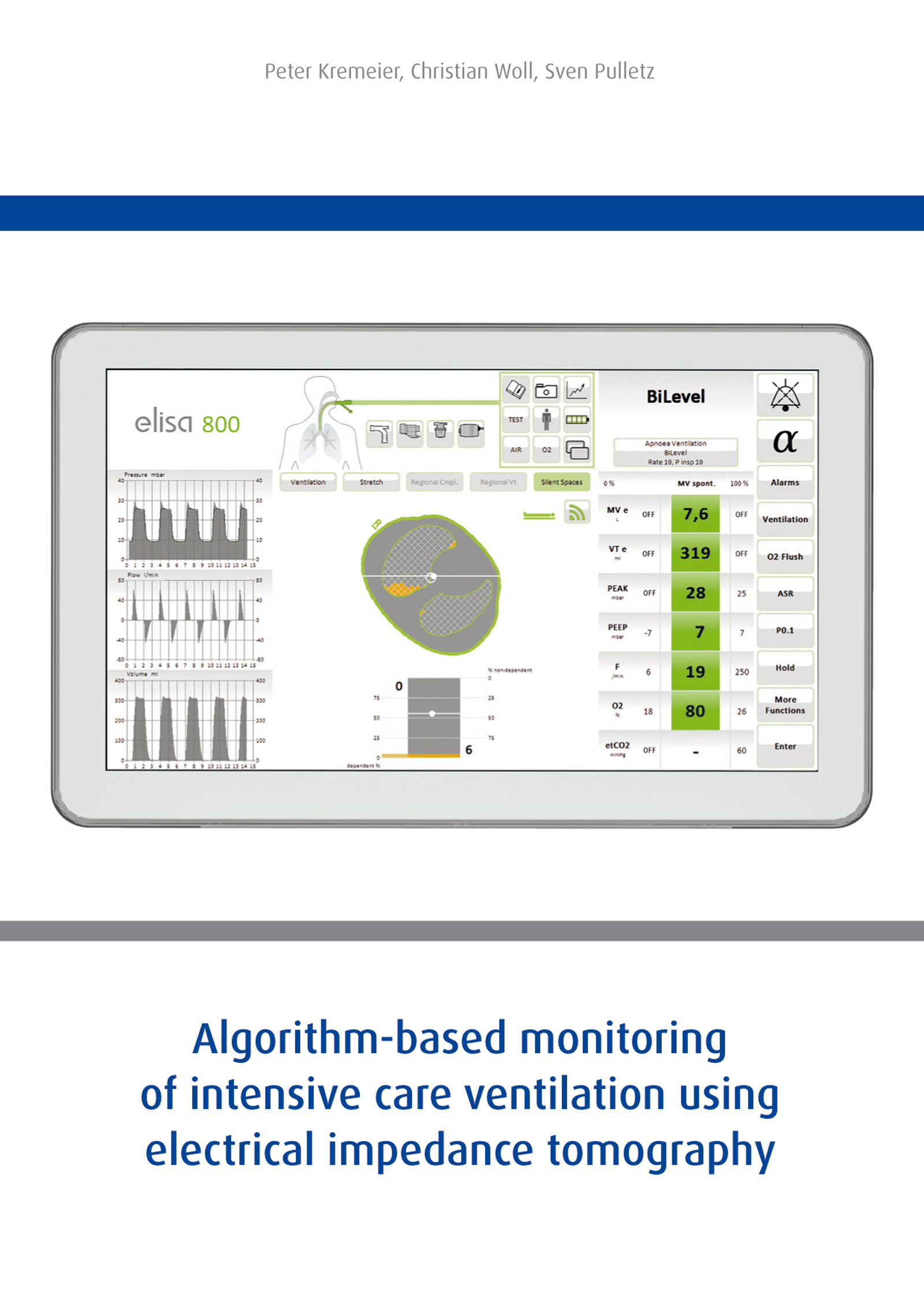 Algorithm-based monitoring of intensive care ventilation using electrical impedance tomography