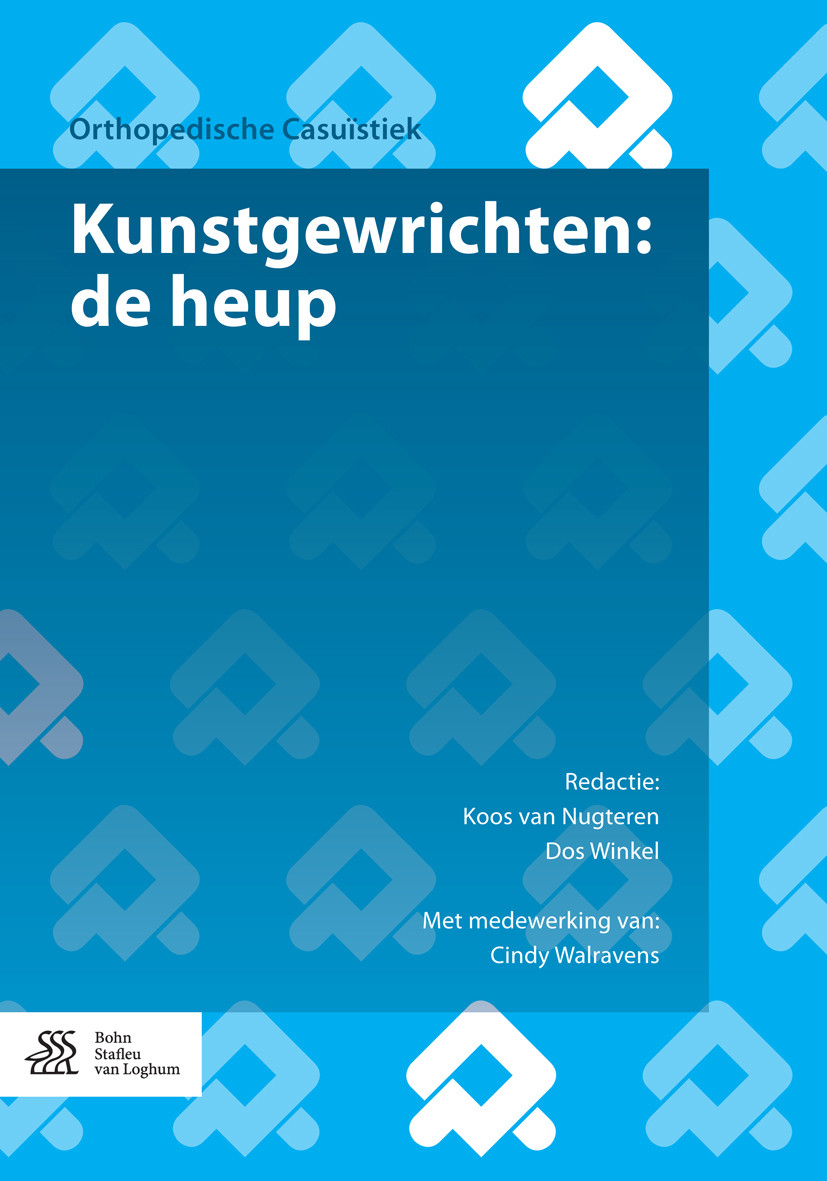 Cover Kunstgewrichten: de heup