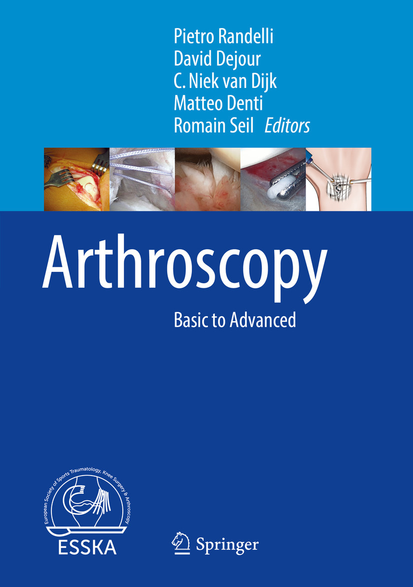 Cover Arthroscopy