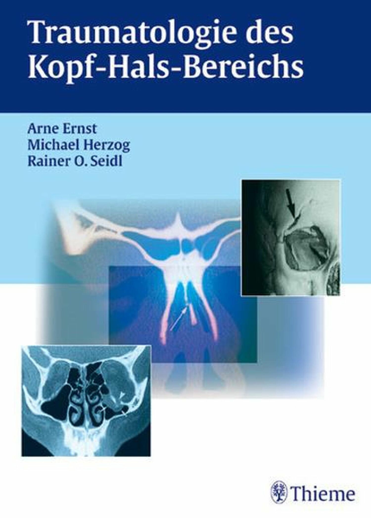 Cover Traumatologie des Kopf-Hals-Bereichs