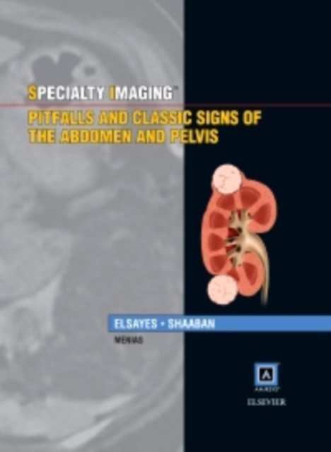 Cover Specialty Imaging: Pitfalls and Classic Signs of the Abdomen and Pelvis
