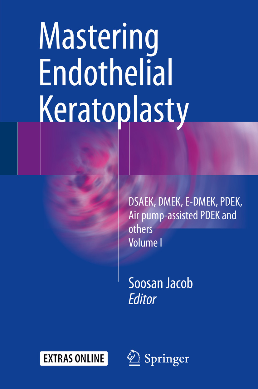 Cover Mastering Endothelial Keratoplasty