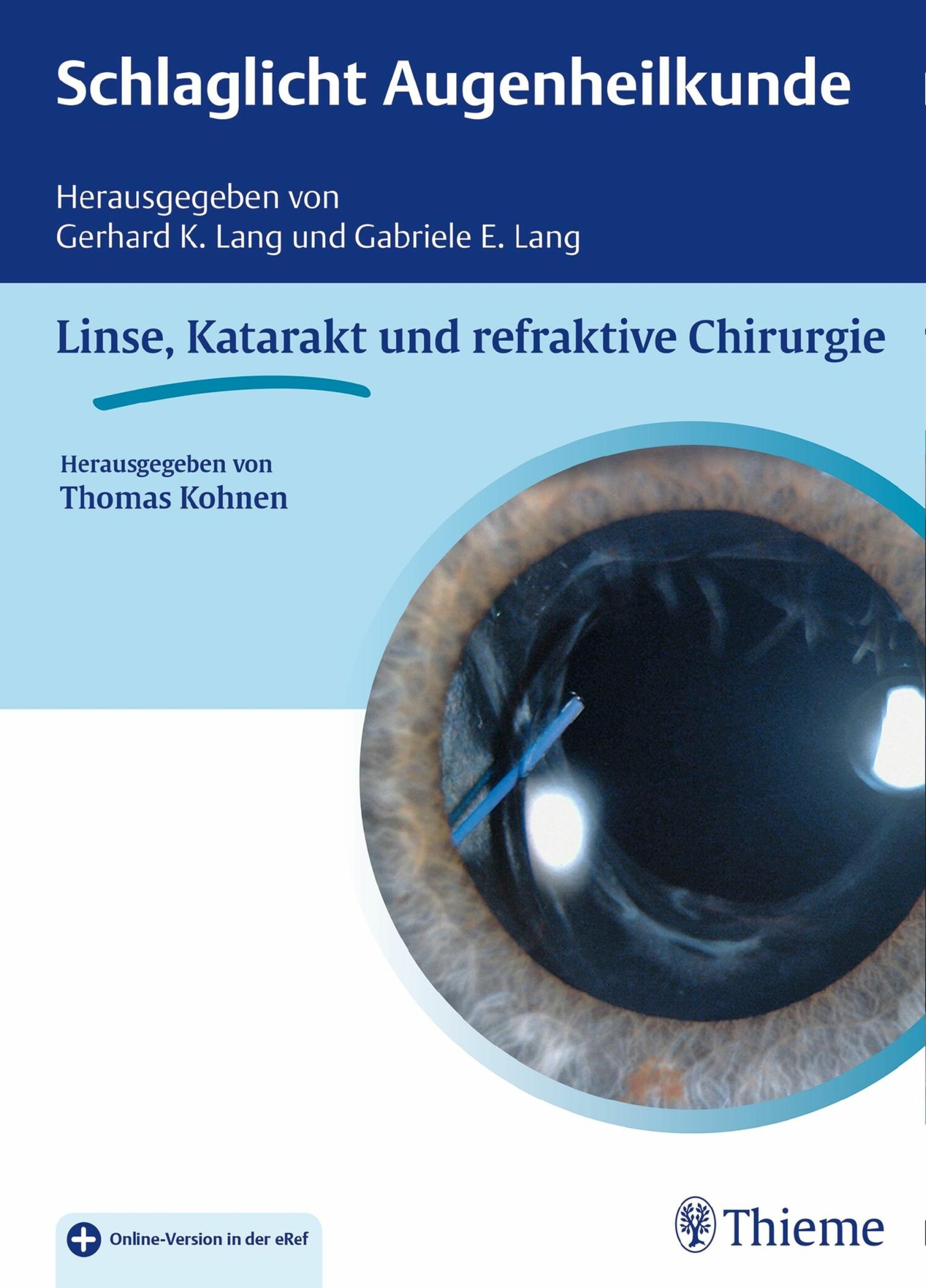 Cover Schlaglicht Augenheilkunde: Linse, Katarakt und refraktive Chirurgie