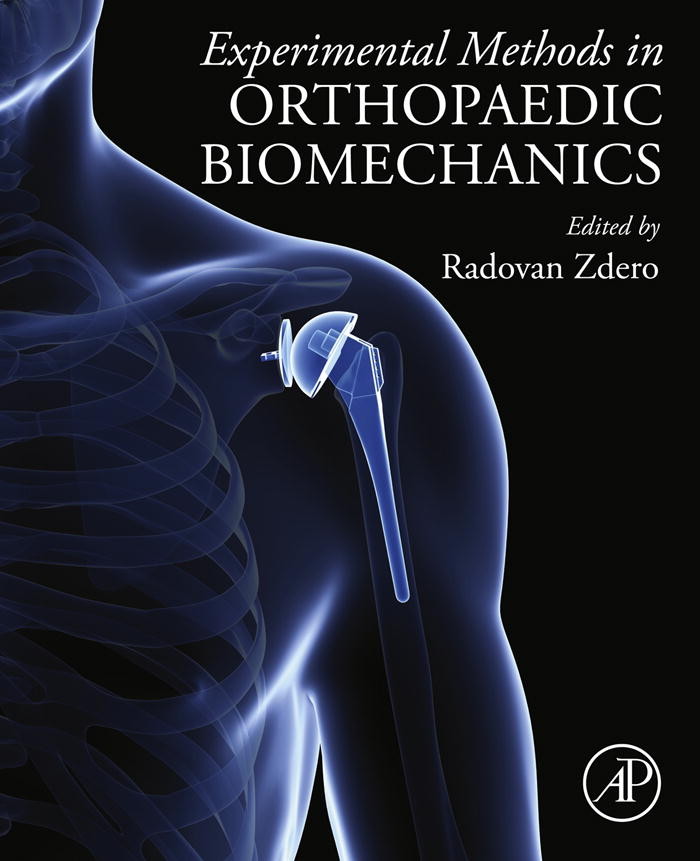Experimental Methods in Orthopaedic Biomechanics