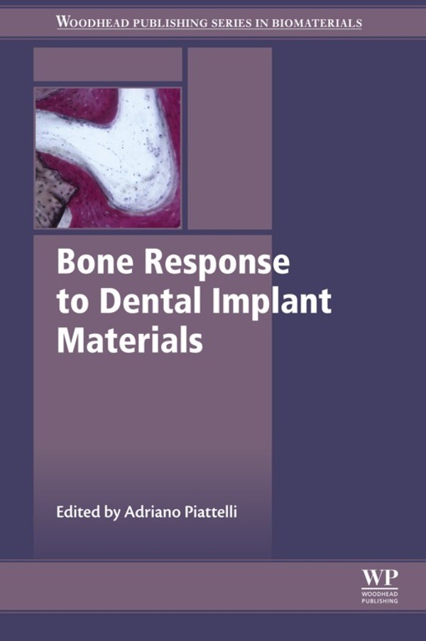 Cover Bone Response to Dental Implant Materials