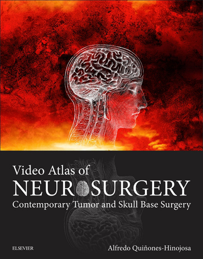 Cover Video Atlas of Neurosurgery