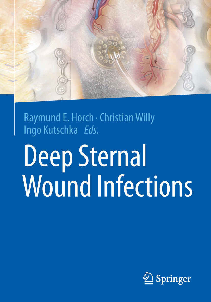 Cover Deep Sternal Wound Infections