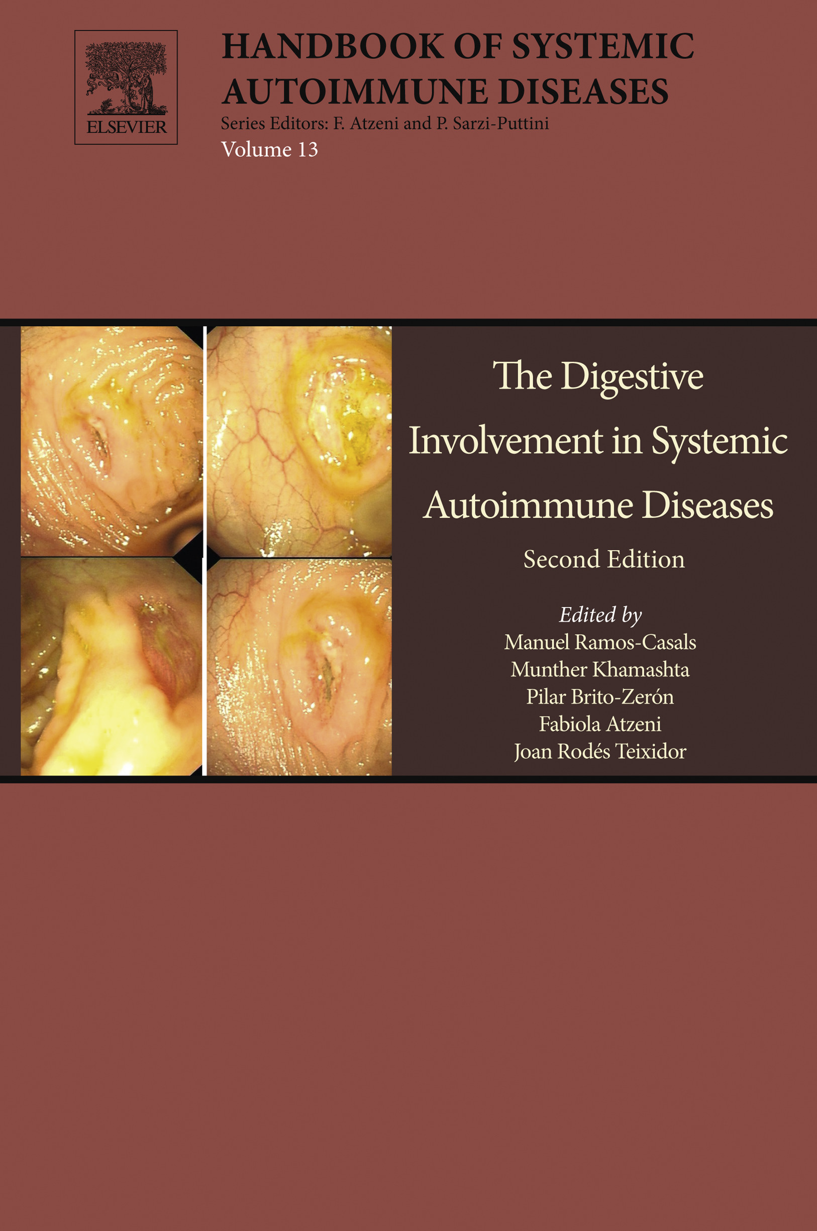 Cover The Digestive Involvement in Systemic Autoimmune Diseases