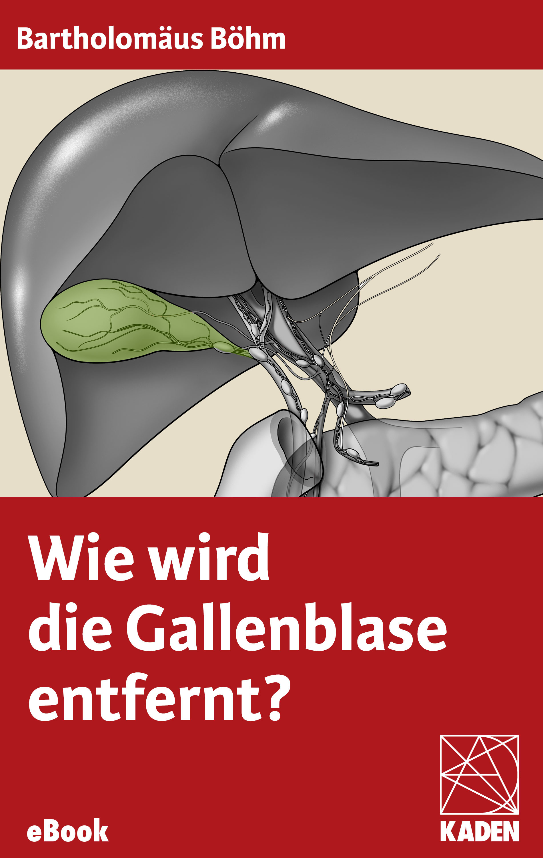 Cover Wie wird die Gallenblase entfernt?