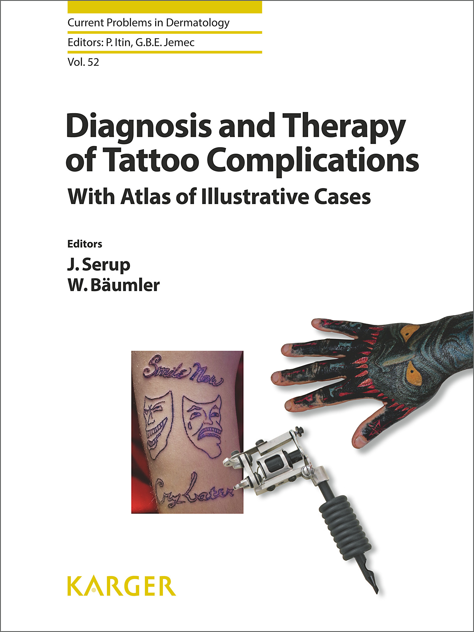 Cover Diagnosis and Therapy of Tattoo Complications
