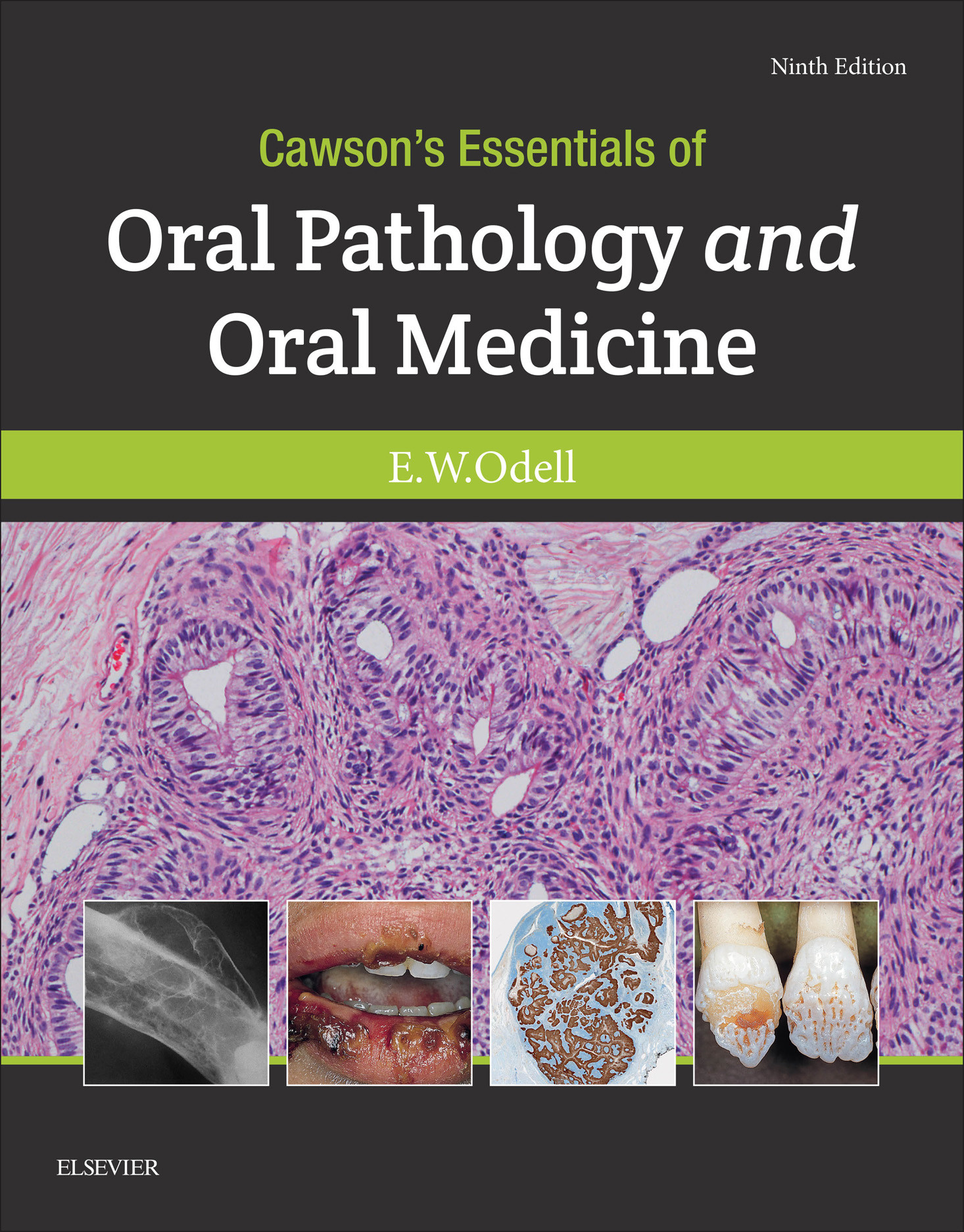 Cawson's Essentials of Oral Pathology and Oral Medicine E-Book