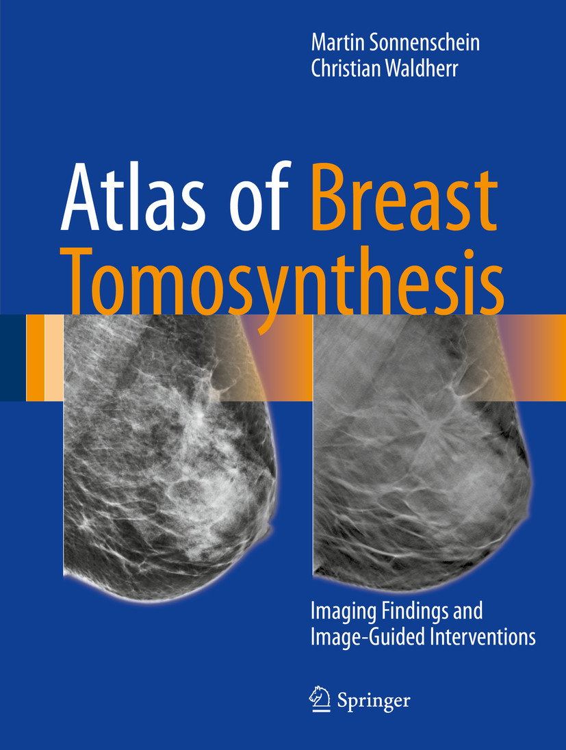 Cover Atlas of Breast Tomosynthesis
