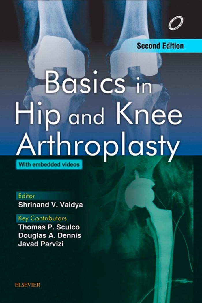 Cover Basics in Hip and Knee Arthroplasty - E-book