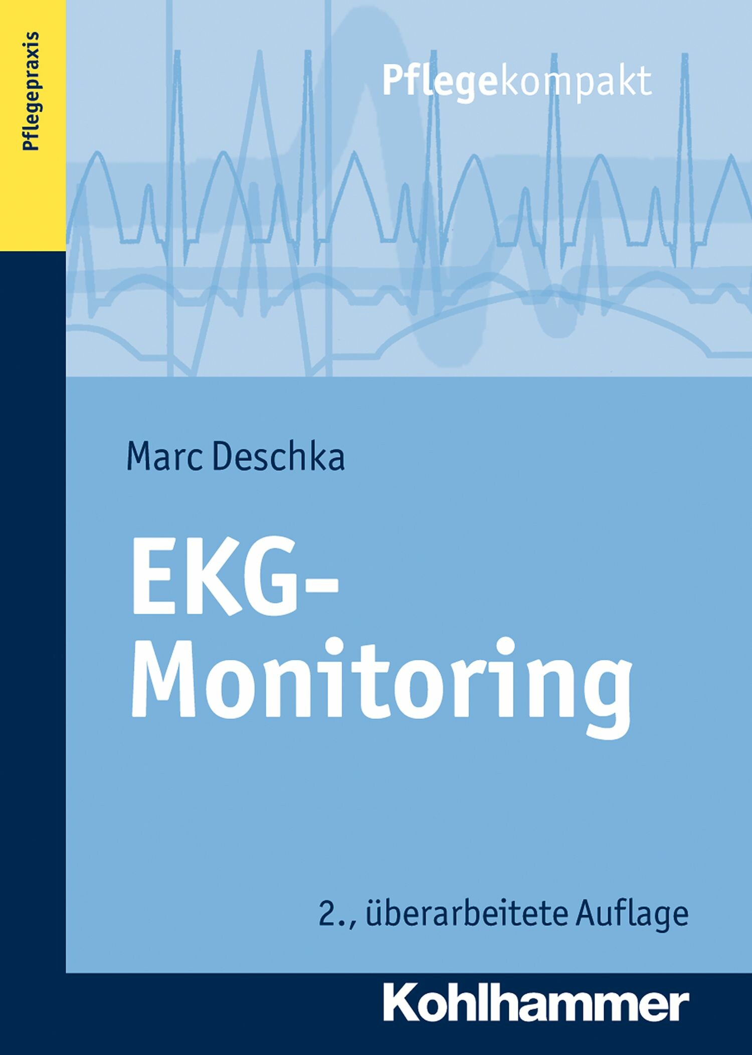 EKG-Monitoring