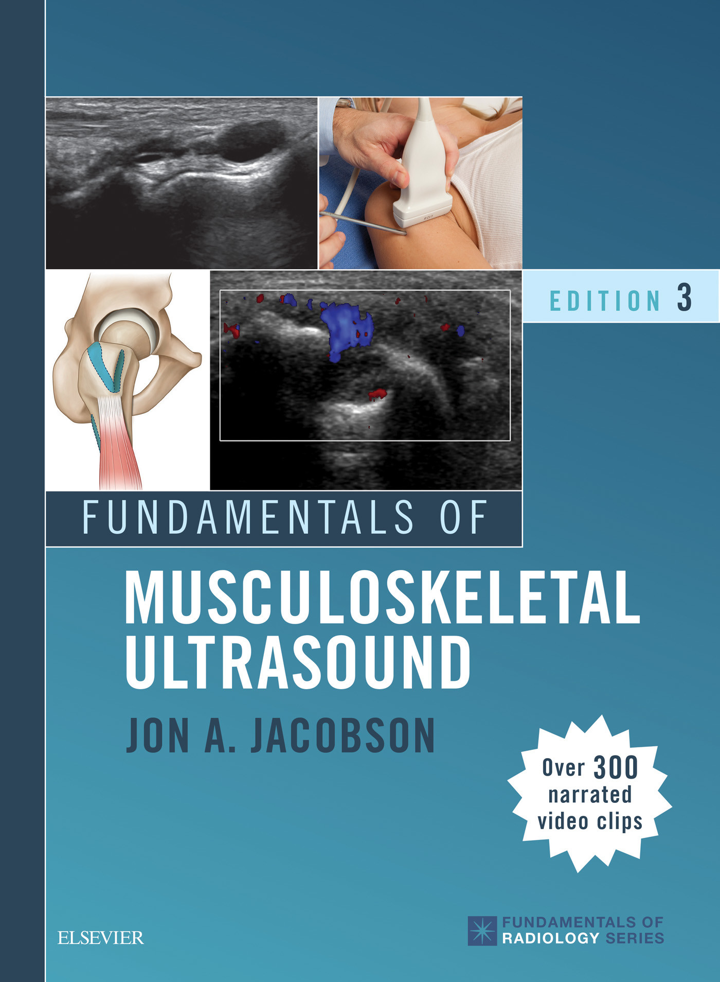 Cover Fundamentals of Musculoskeletal Ultrasound E-Book