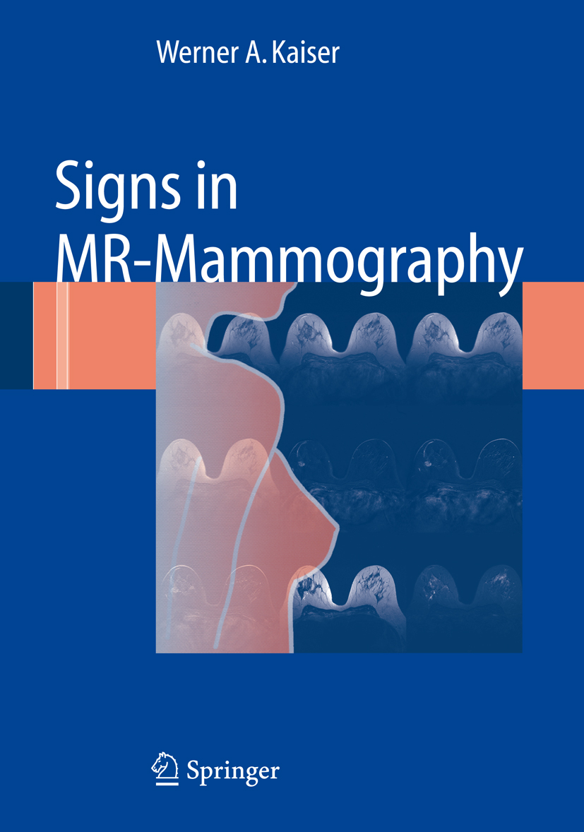 Cover Signs in MR-Mammography