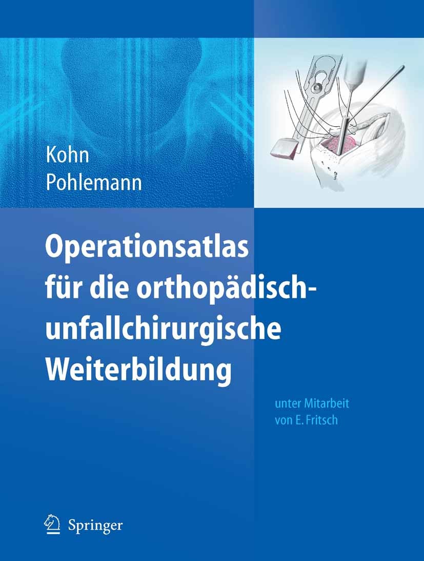 Cover Operationsatlas für die orthopädisch-unfallchirurgische Weiterbildung