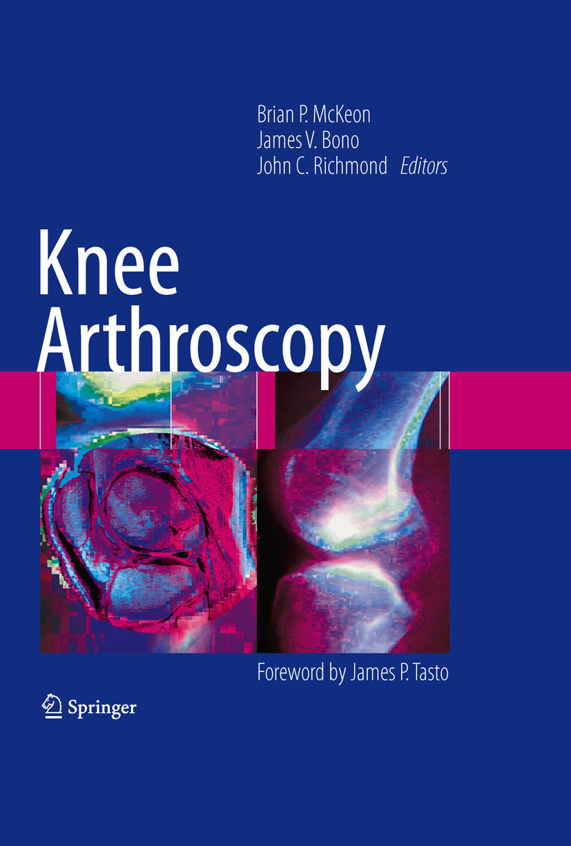 Cover Knee Arthroscopy