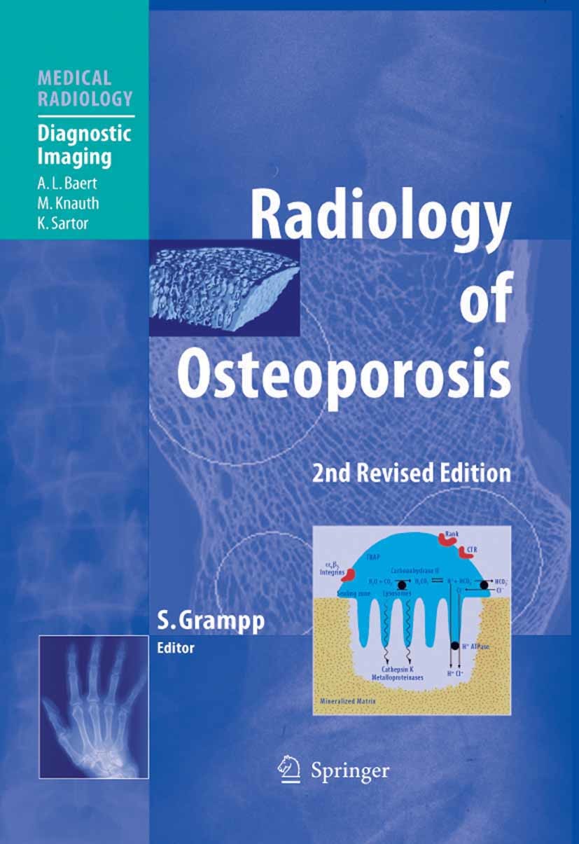 Radiology of Osteoporosis