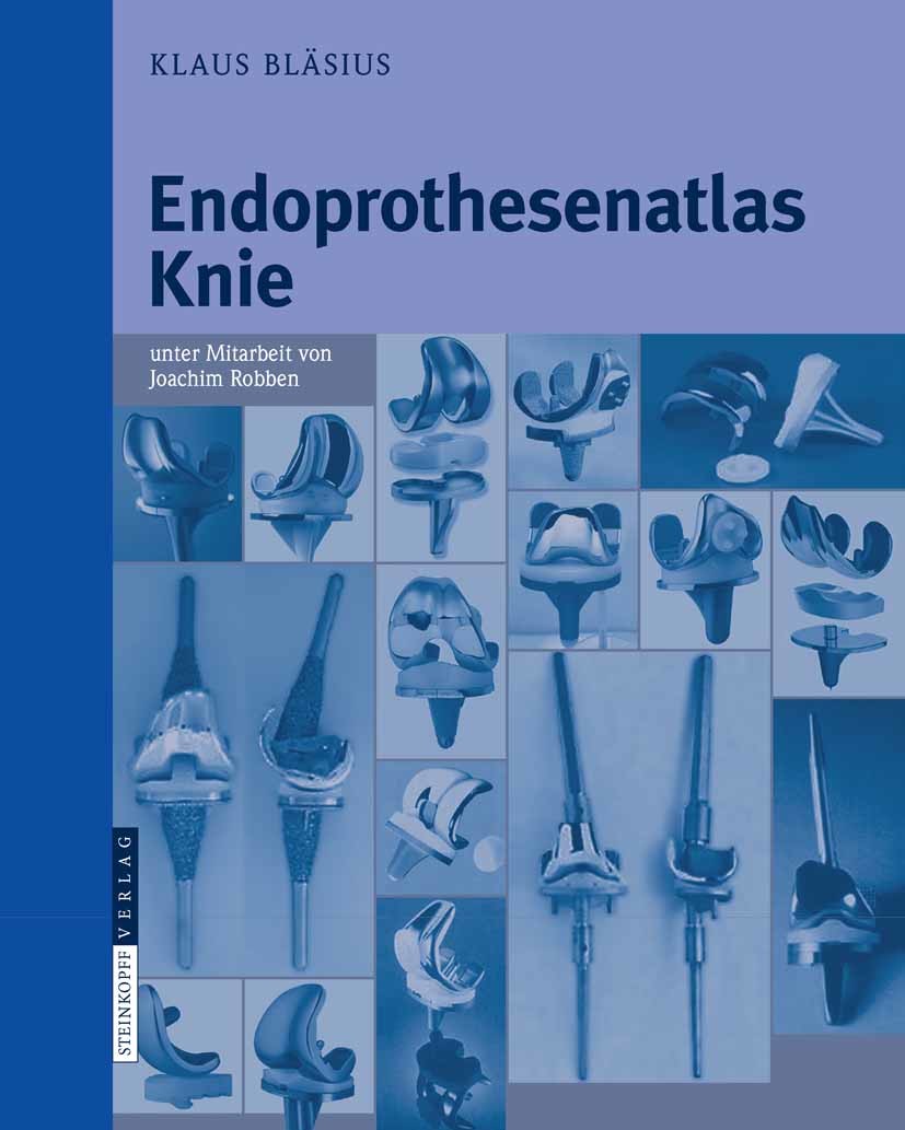 Cover Endoprothesenatlas Knie