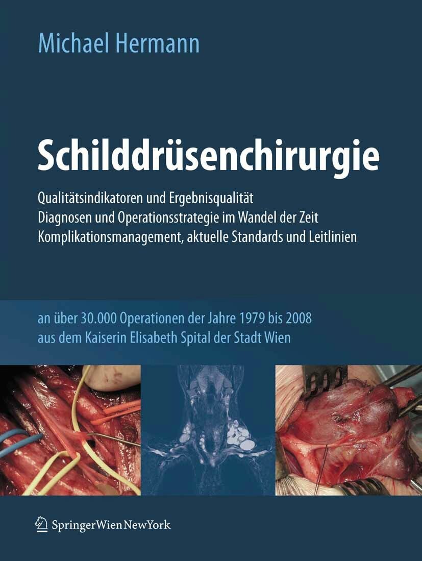 Cover Schilddrüsenchirurgie - Qualitätsindikatoren und Ergebnisqualität, Diagnosen und Operationsstrategie im Wandel der Zeit, Komplikationsmanagement, aktuelle Standards und Leitlinien