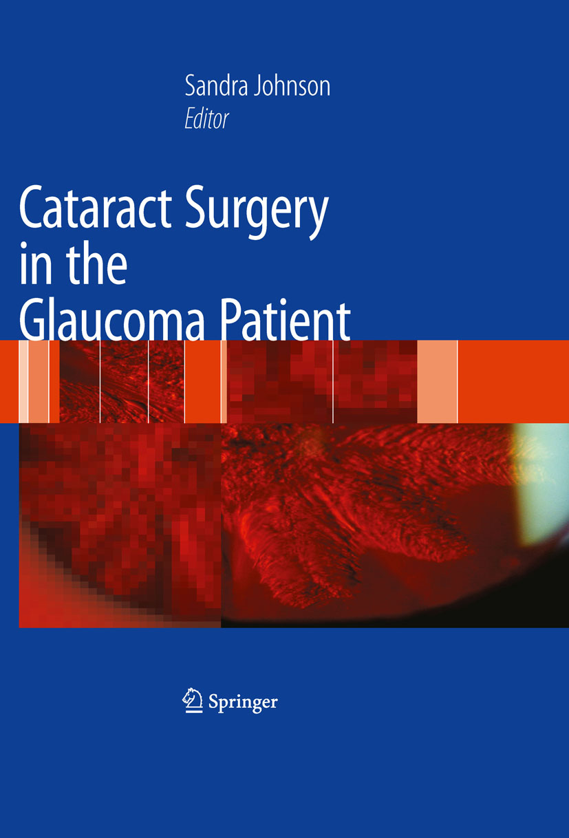 Cover Cataract Surgery in the Glaucoma Patient