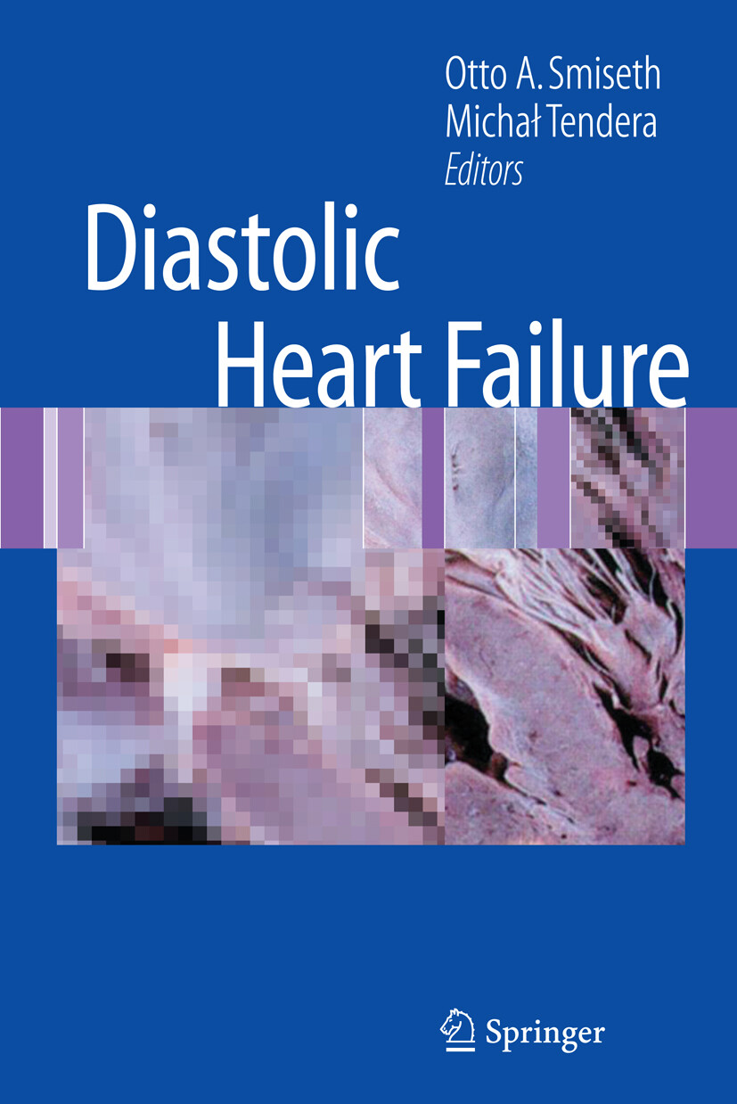 Diastolic Heart Failure