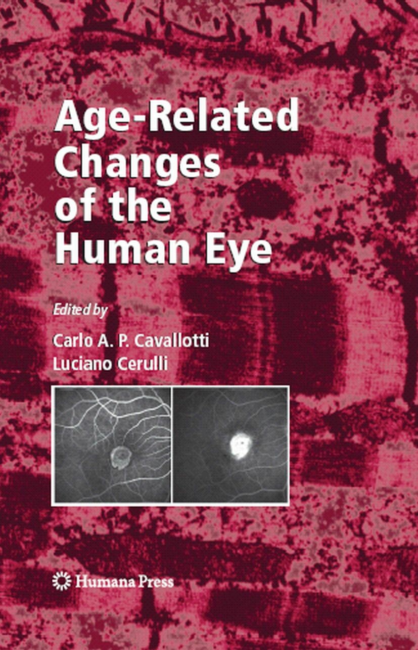 Cover Age-Related Changes of the Human Eye
