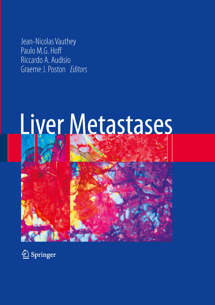 Cover Liver Metastases