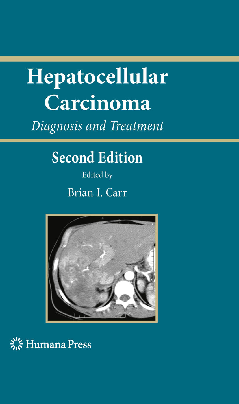 Cover Hepatocellular Carcinoma