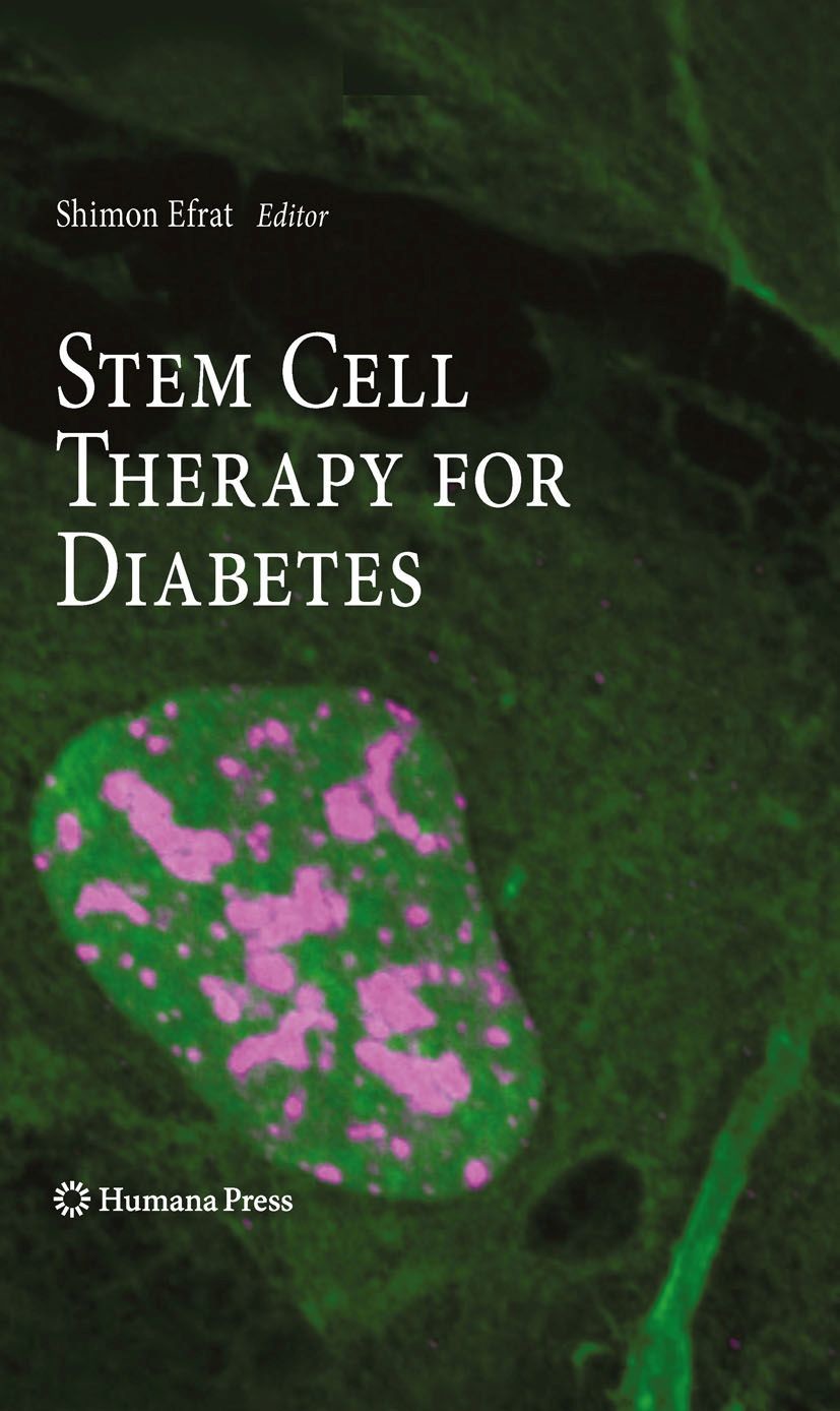 Cover Stem Cell Therapy for Diabetes