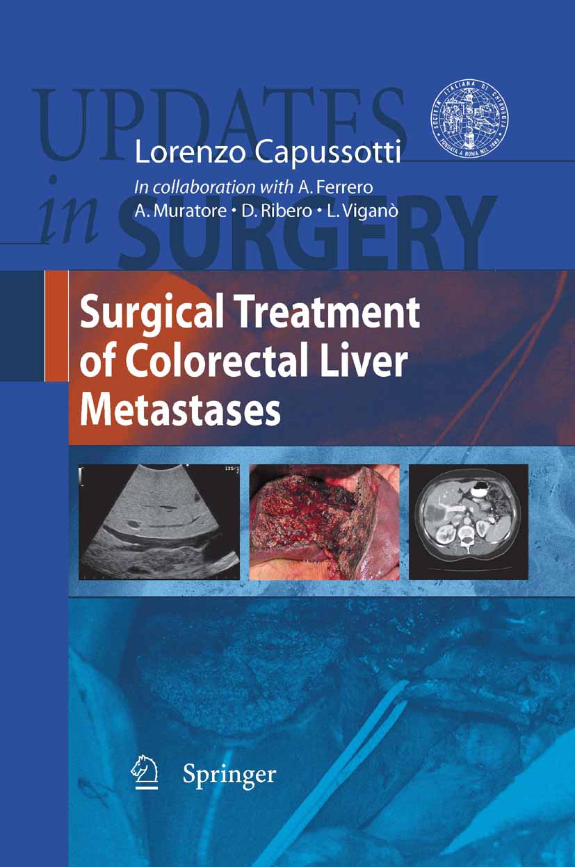 Cover Surgical Treatment of Colorectal Liver Metastases