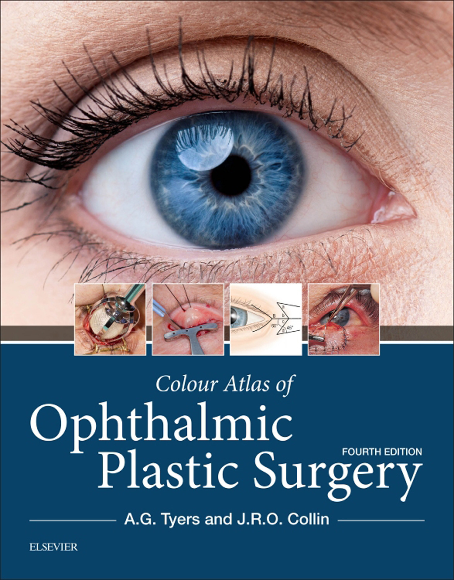 Colour Atlas of Ophthalmic Plastic Surgery E-Book