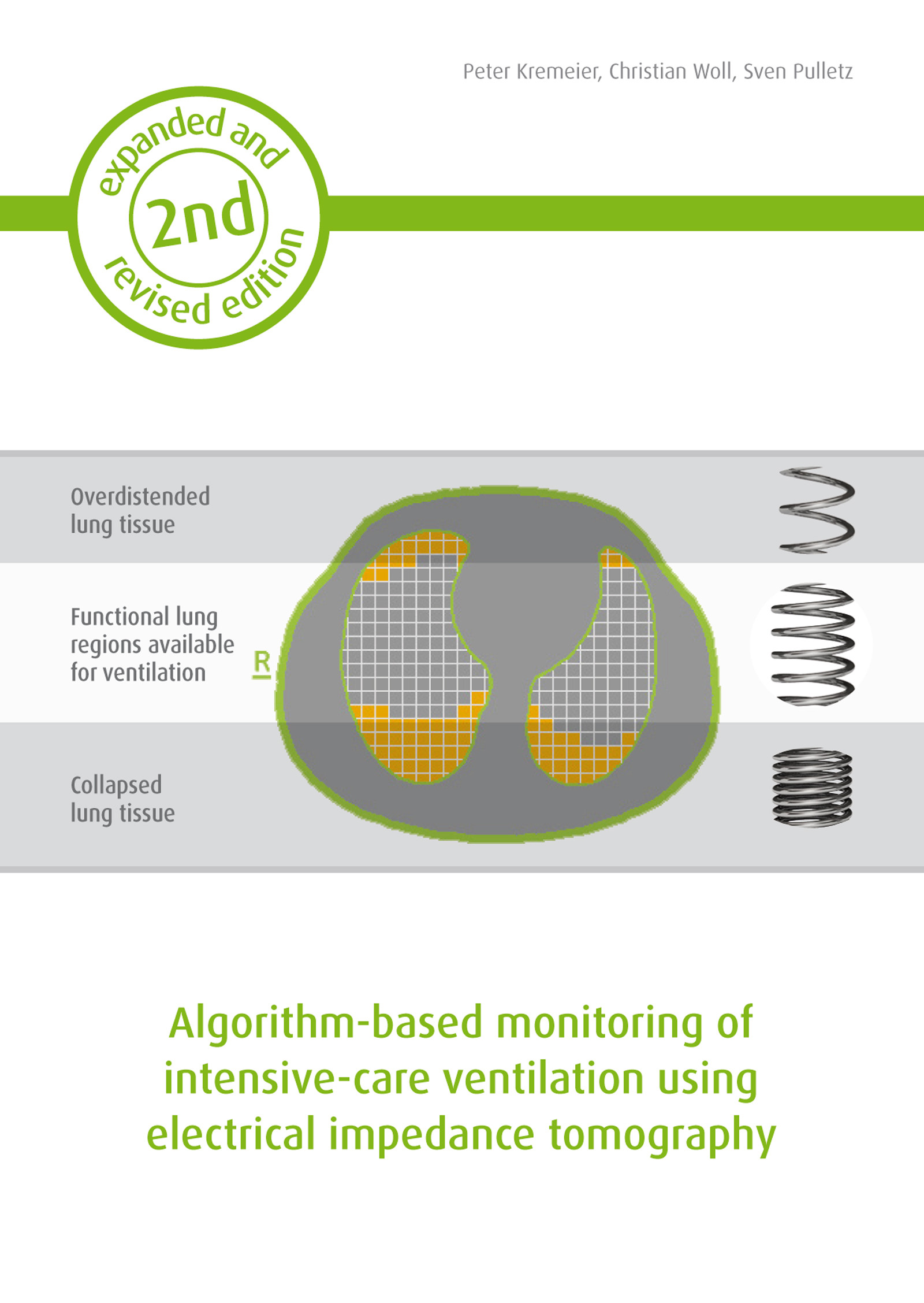 Algorithm-based monitoring of intensive-care ventilation using electrical impedance tomography