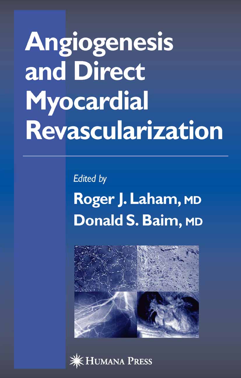 Angiogenesis and Direct Myocardial Revascularization