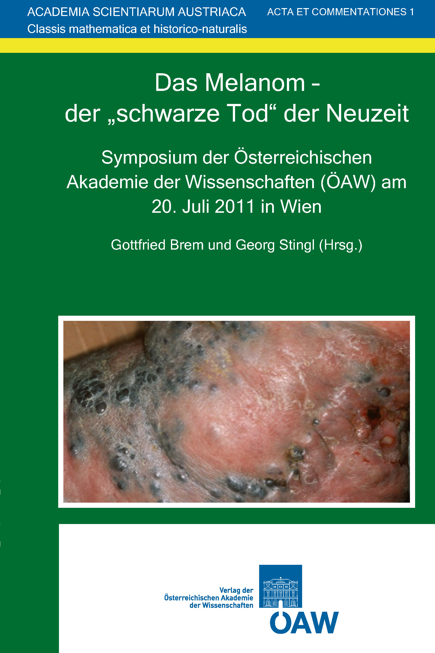 Cover Das Melanom - der 'schwarze Tod' der Neuzeit