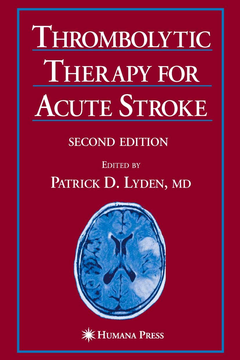 Cover Thrombolytic Therapy for Acute Stroke