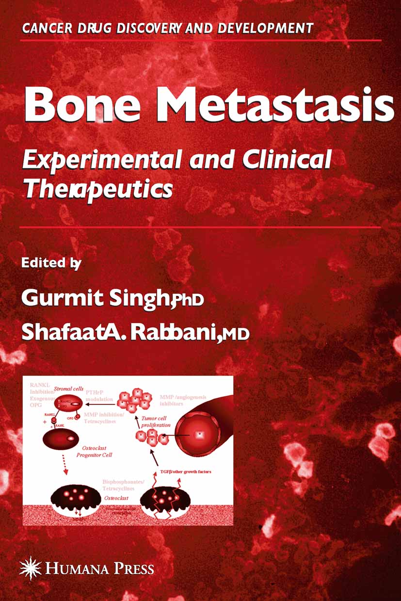 Cover Bone Metastasis