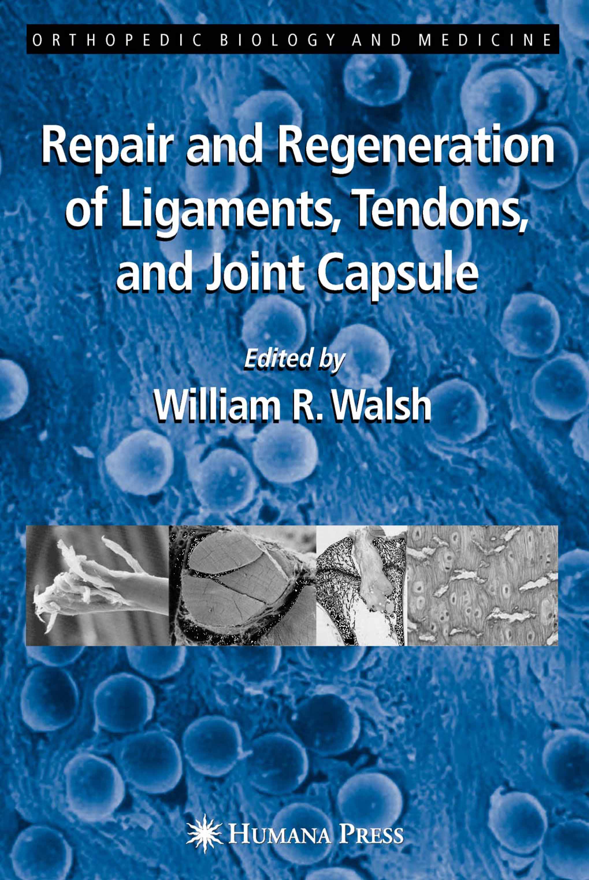Cover Repair and Regeneration of Ligaments, Tendons, and Joint Capsule