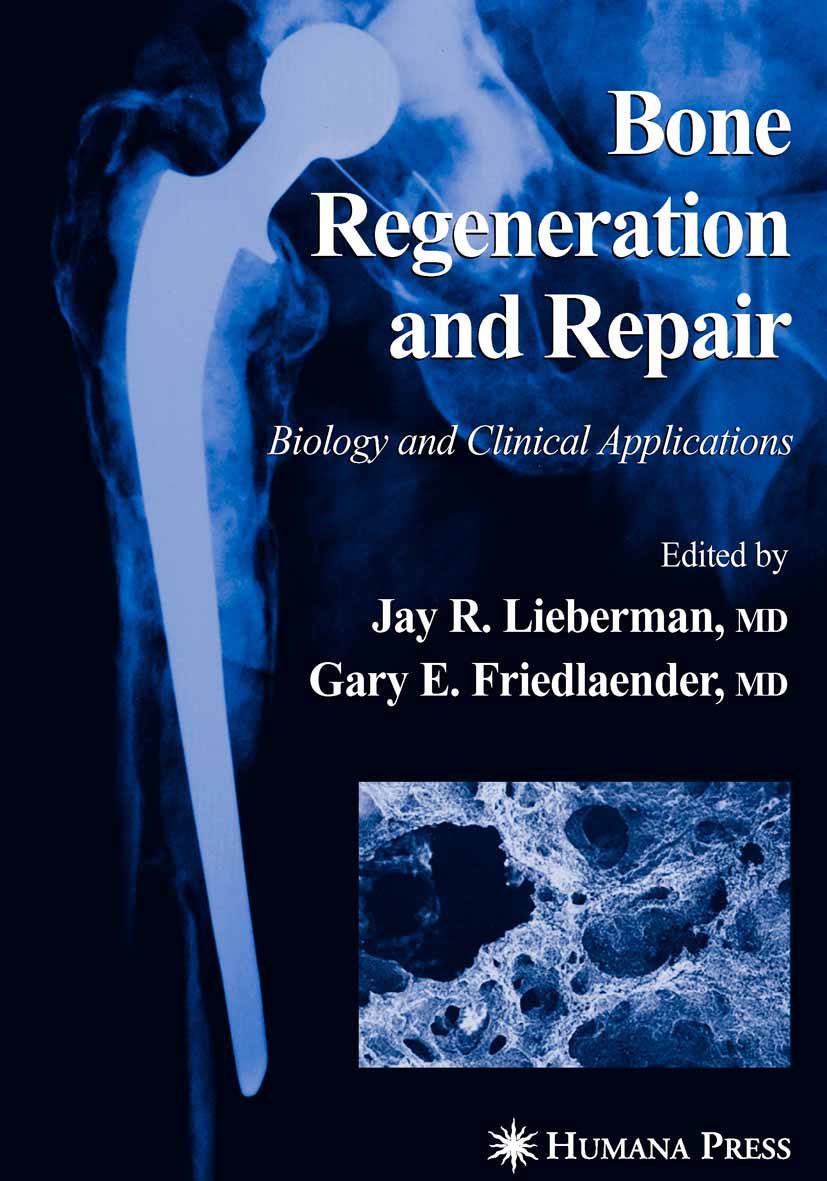 Cover Bone Regeneration and Repair