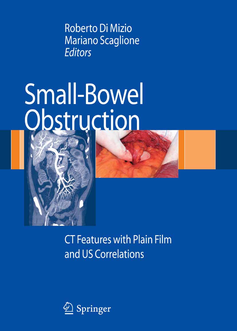 Cover Small-Bowel Obstruction