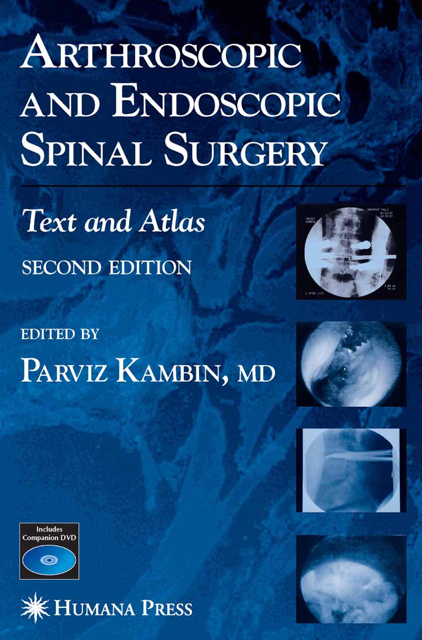 Arthroscopic and Endoscopic Spinal Surgery