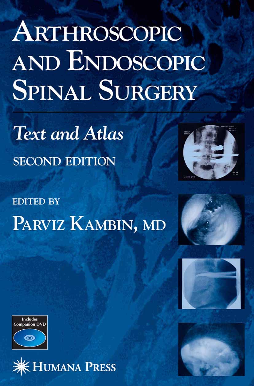Cover Arthroscopic and Endoscopic Spinal Surgery