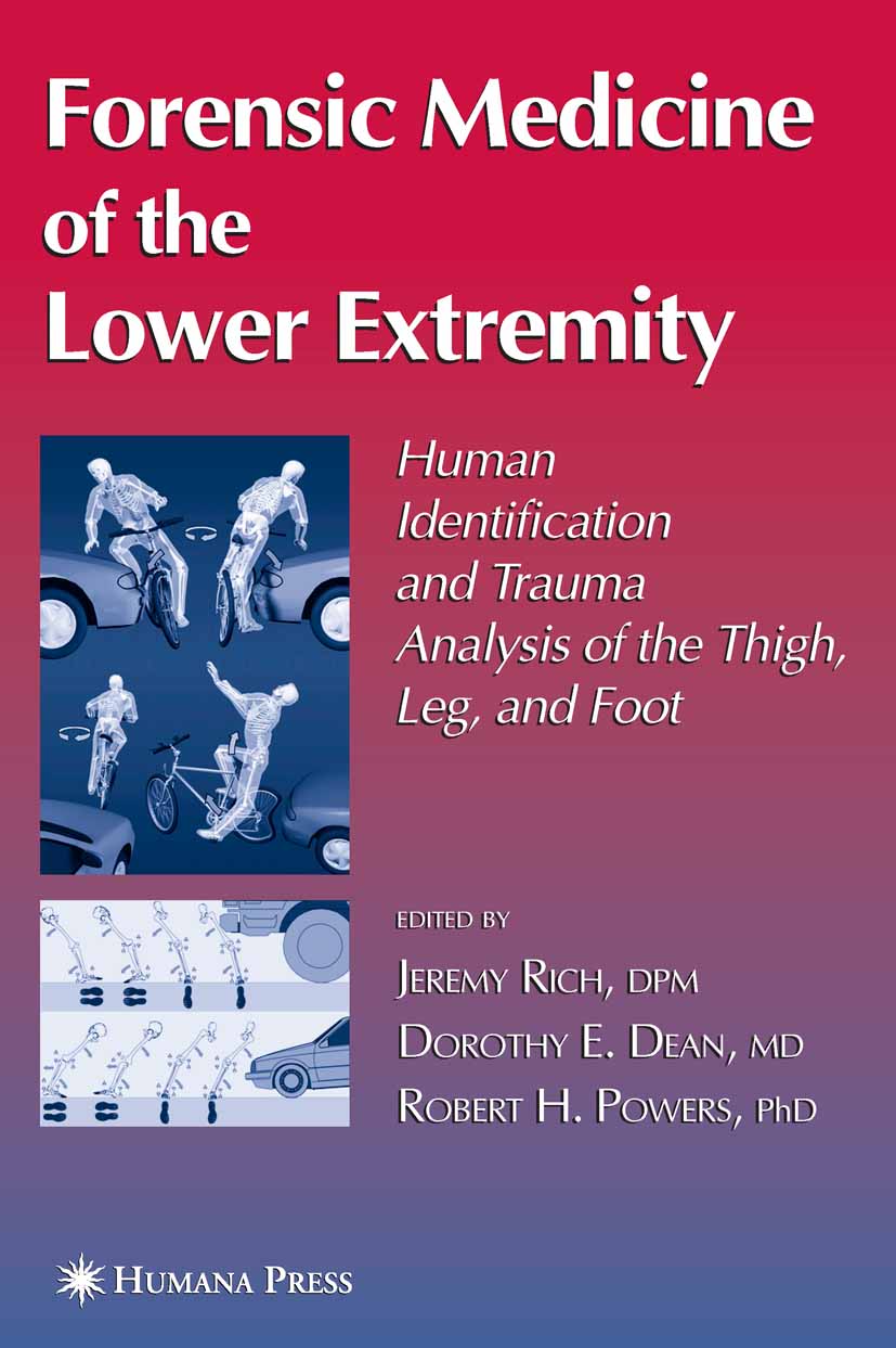 Cover Forensic Medicine of the Lower Extremity